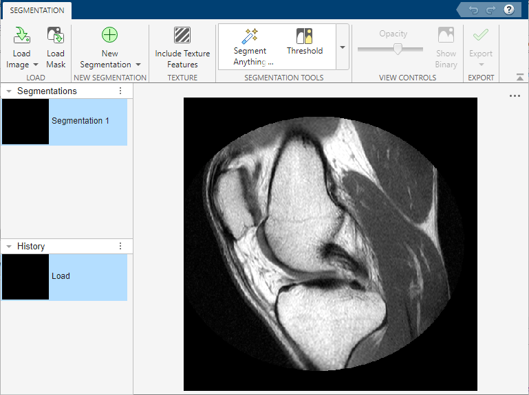 MRI image of a knee loaded into the Image Segmenter app