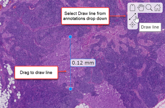 The imageshow viewer window, showing how to add line annotations for measuring distances between two points