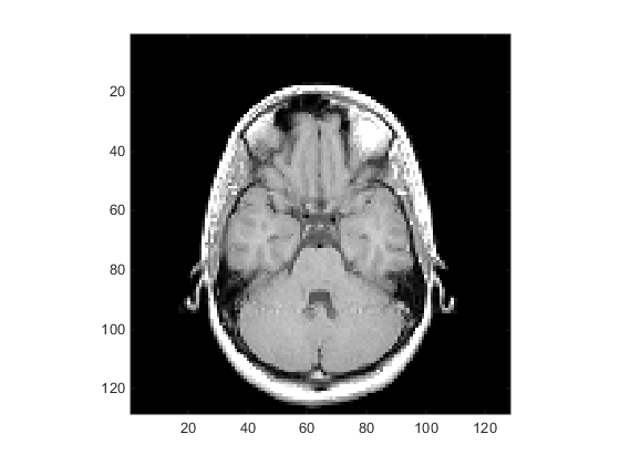 Cross section of a human head displayed as a grayscale image