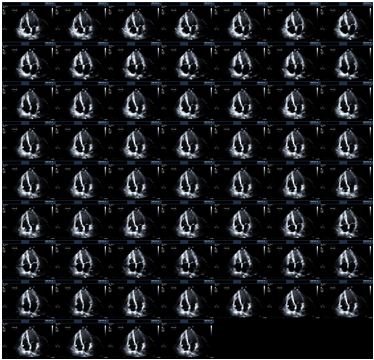 Montage of 2-D medical image data