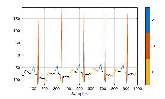 QT-wave electrocardiogram data set. The figure shows eight signals in the time domain.