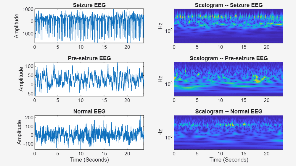 Plots of seizure, pre-seizure, and normal EEG time-series data alongside their corresponding scalograms.