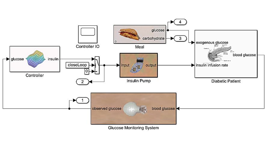 In silico medicine example model of an artificial pancreas and a diabetic patient.